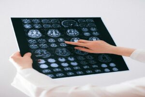 Innovative Approaches to Neurological Health and Wellness - Flavourmag